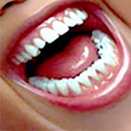 children's dental care